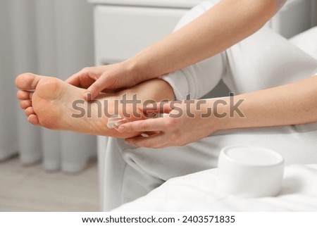 Young woman with dry skin applying cream onto her foot indoors, closeup