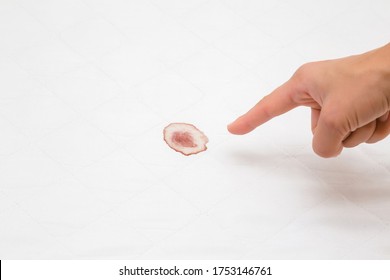 Young Woman Finger Pointing To Mattress Blood Stain After Night Menstruation. Fresh Or Old Stains Cleaning From White Sheet Of Bed. Closeup.