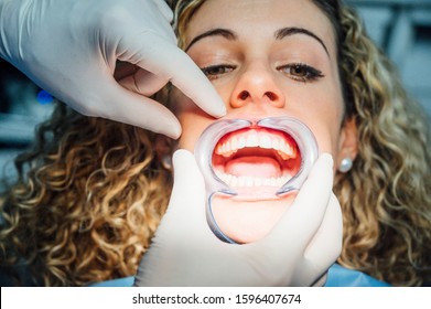 Young Woman Getting Braces Put On Teeth