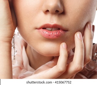 Young Woman Has Chapped Lips