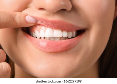 Young woman with healthy gums, closeup