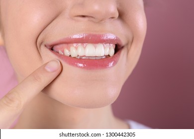 Young woman with healthy teeth and beautiful smile on color background, closeup - Shutterstock ID 1300442305