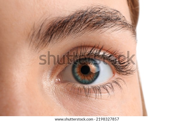 central heterochromia iridum