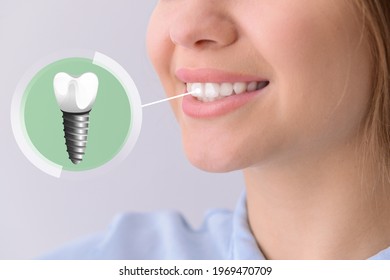 Young woman with implanted teeth on light background, closeup - Powered by Shutterstock