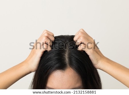 Young woman itchy head There is a fungus on the scalp dandruff, red rash She scratched her head to bring relief. Need to consult a doctor. Hair problems hair loss. Shot on isolated background