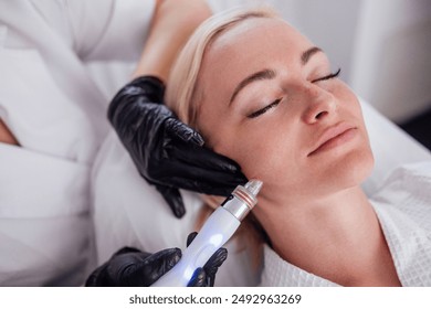 Young woman lies with her eyes closed during hardware moisturizing of the facial skin. The blonde relaxes and enjoys a rejuvenating spa treatment in a beauty salon or clinic. - Powered by Shutterstock