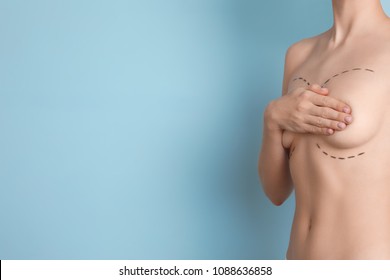 Young woman with marks on breasts for cosmetic surgery operation against color background