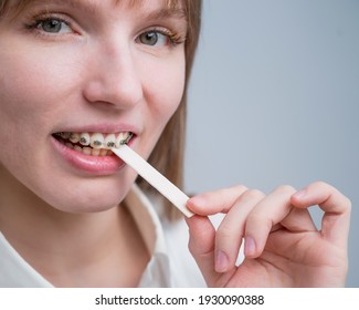 Young Woman With Metal Braces On Her Teeth Is Chewing Gum. The Girl Is Eating Gummy Candy