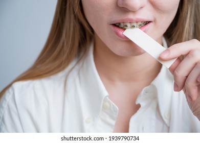 Young Woman With Metal Braces On Her Teeth Is Chewing Gum. The Girl Is Eating Gummy Candy