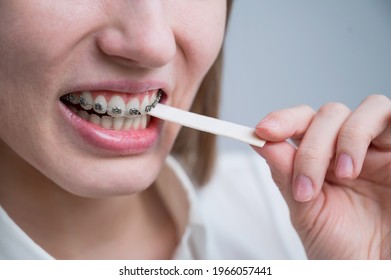 Young Woman With Metal Braces On Her Teeth Is Chewing Gum. The Girl Is Eating Gummy Candy