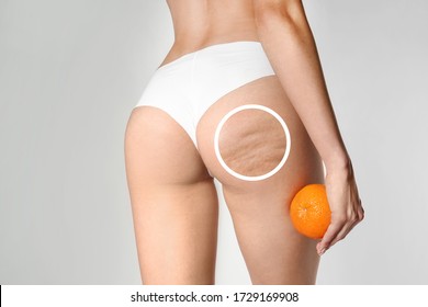 Young woman with orange on light background. Problem of cellulite - Shutterstock ID 1729169908