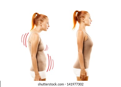 Young woman with position defect and ideal bearing on white background - Shutterstock ID 141977302