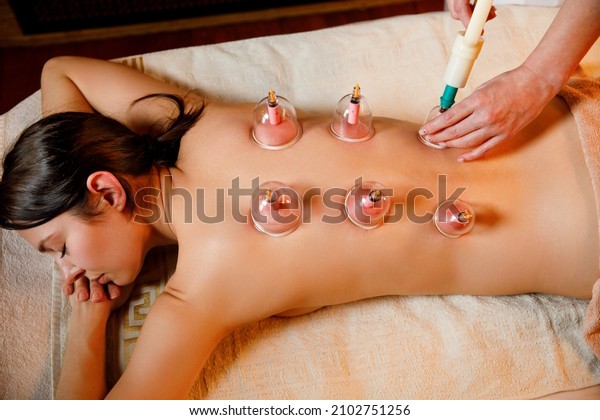 A young woman relaxes in a massage parlor.\
Vacuum cups of medical cupping therapy on woman back, close up,\
chinese medicine.