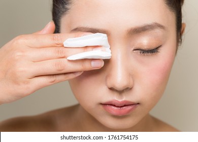 A Young Woman Is Removing Makeup With Cotton.