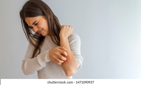 Young Woman Scratching Arm From Having Itching On White Background. Cause Of Itchy Skin Include Insect Bites, Dermatitis, Food/drugs Allergies Or Dry Skin. Health Care Concept. Close Up.