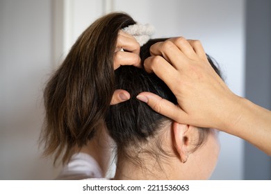 Young Woman Scratching Her Itchy Head Scalp