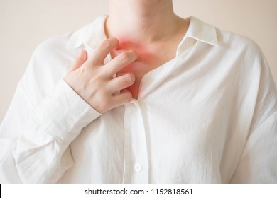 Young Woman Scratching The Itch On Her Chest And Neck W/ Redness Rash. Cause Of Itchy Skin Include Dermatitis, Food/drugs Allergies, Dry Skin Or Insect Bites. Health Care Concept. Close Up.