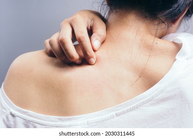 Young woman scratching the skin with itchy skin fungus, allergic to sweat.