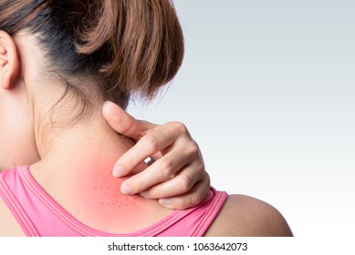 Young Woman Scratching Upper Back Or Neck Rash On White Background 