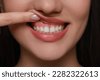 dental gums