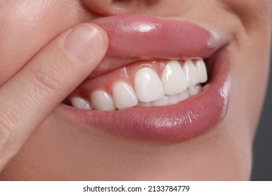 Young Woman Showing Healthy Gums, Closeup View