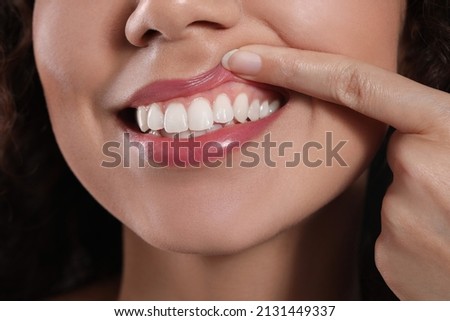 Young woman showing healthy gums, closeup view