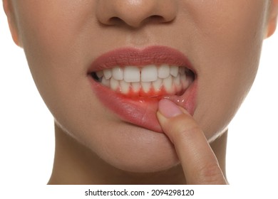 Young Woman Showing Inflamed Gums, Closeup View