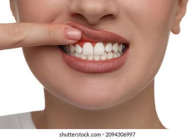 Young Woman Showing Inflamed Gums, Closeup View