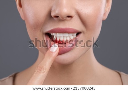 Young woman showing inflamed gums on grey background, closeup Stockfoto © 