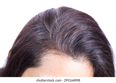 Young Woman Shows Her Gray Hair Roots