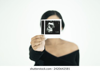 Young woman shows ultrasound image of her baby, focus on ultrasound image