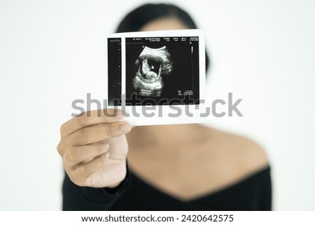 Young woman shows ultrasound image of her baby, focus on ultrasound image
