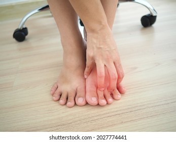 Young Woman Sitting On Chair,  Massaging Tired Foot Relieving Pain Ache In Office, Have Strained Muscles. Closeup Photo, Blurred.