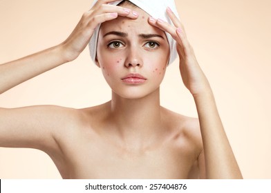 Young woman squeezing her pimple, removing pimple from her face. Woman skin care concept 