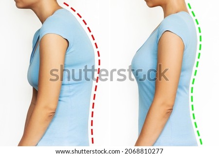 A young woman stands bent and straightened isolated on a white background. Correct and incorrect spine position. Slouching back and healthy spine. A posture before and after changing. Scoliosis