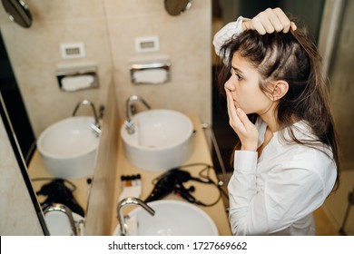 Young Woman Suffering From Alopecia. Female Hair Loss.Worried Female Looking Her Hairline In The Mirror.Stress Caused Problem, Autoimmune Disease.Balding From Hair Care Products,allergic Reaction