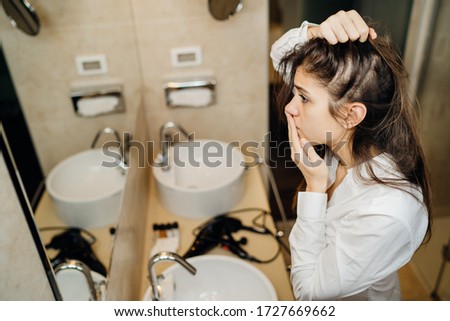 Young woman suffering from alopecia. Female hair loss.Worried female looking her hairline in the mirror.Stress caused problem, autoimmune disease.Balding from hair care products,allergic reaction