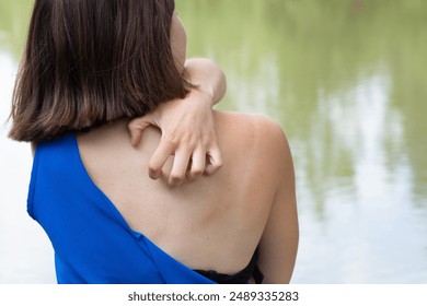 Young woman is suffering from itchy skin on her back while standing near a lake on a summer day - Powered by Shutterstock