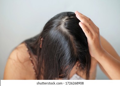 Young Woman With Thin Hair Problem,closeup.