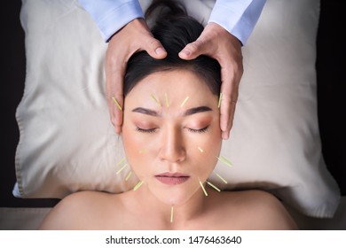 young woman undergoing acupuncture treatment on face