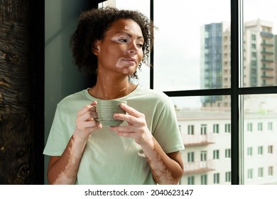 Young woman with vitiligo drinking coffee by window indoors - Powered by Shutterstock