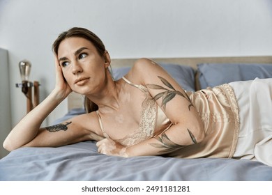 A young woman with vitiligo and a tattoo lies on her bed, gazing thoughtfully out the window. - Powered by Shutterstock