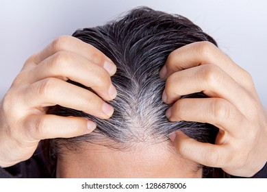 Young Woman With White Hair Problem