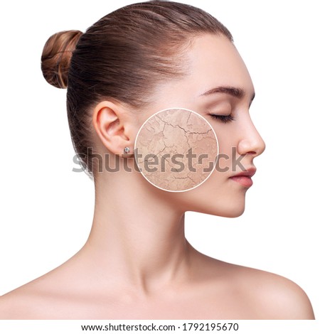 Young woman with zoom circle shows dry facial skin before moistening. Skincare concept.