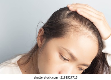 Young women stressed and having hair loss, thinning hair - Shutterstock ID 2191529715