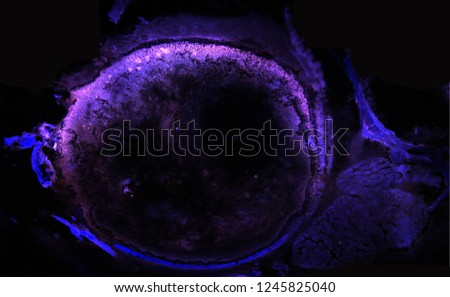 Zebrafish eyeball with brain section flourescent