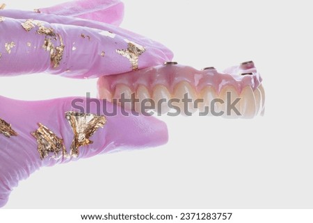 Zirconium Arch with Screw Retained Implants and Artificial Gum