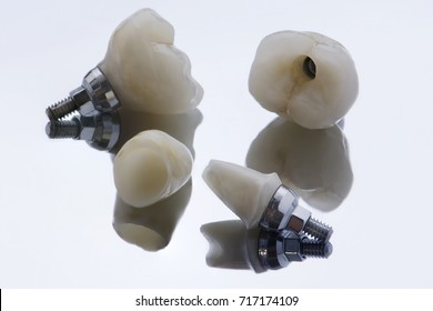 zirconium crown and zirconium hybrid abutment - Shutterstock ID 717174109