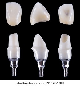 Zirconium crown and zirconium hybrid abutment on a black background. Front view, side view and rear view.Isolated.
