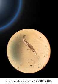 Zoological Specimen Of A Roundworm Under A Microscope